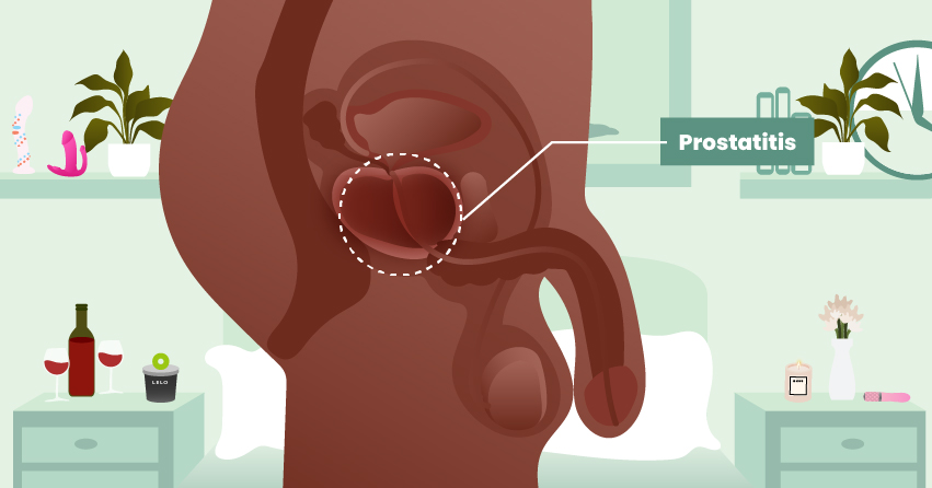 Prostate Play 101: How to Massage Your Prostate Gland