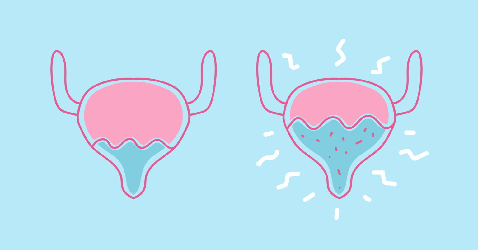 Peeing After Sex? Here's Why Every Woman Should Do It