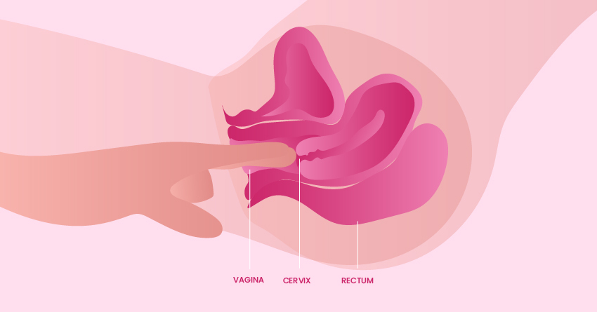 A demonstration of pressing a cervix. 