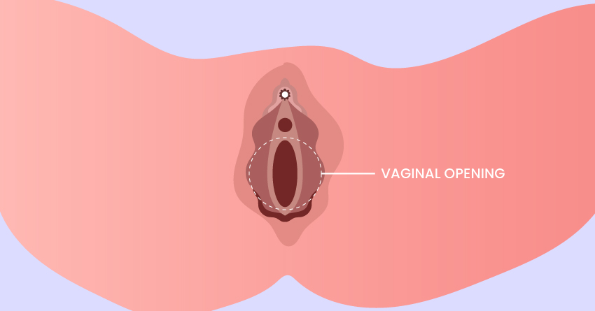 Vaginal Opening