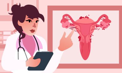 Endometriosis 101: Things You Should Know