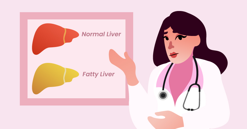 A woman explaining nonalcoholic steatohepatitis. 