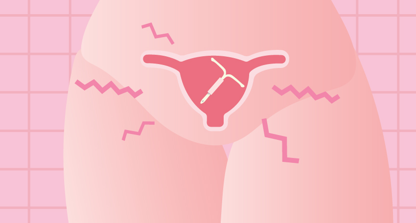 Is IUD an Effective Birth Control? Here's What You Need to Know