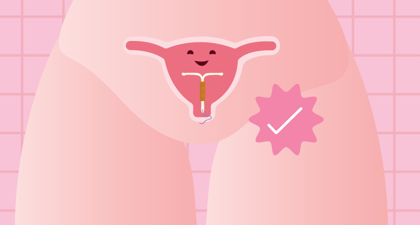 Is IUD an Effective Birth Control? Here's What You Need to Know