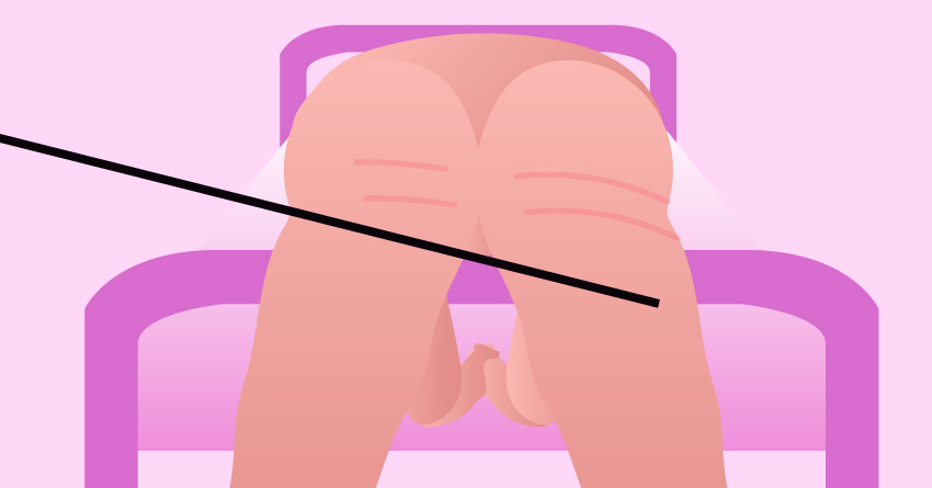 A butt with whip marks. 