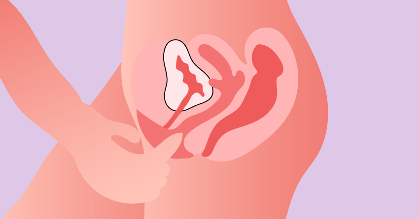 Insertion