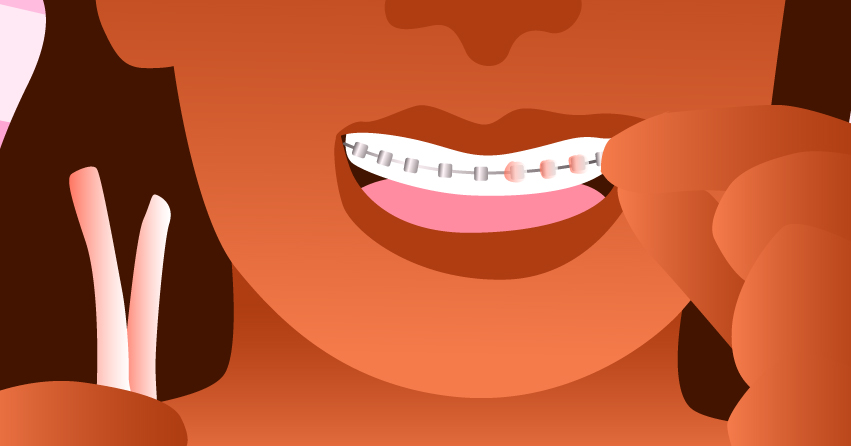 Braces & BJs: How to Give Oral Without the Ouch