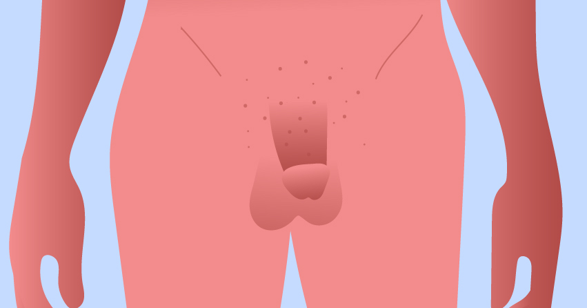 22 Diverse Types of Penis Out There
